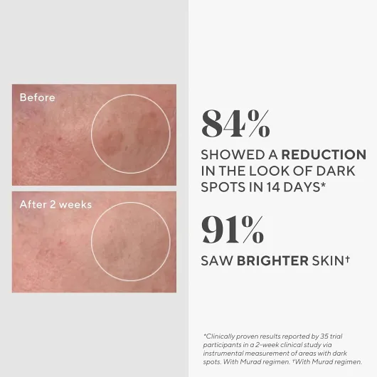 71Me- GtdeL._SL1500_